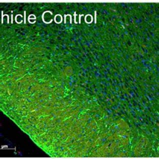 Assessment Of Neuroinflammation After Cerebral Ischemia Reperfusion