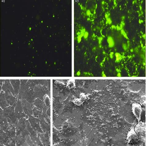 Respiratory Syncytial Virus Rsv Infection Of Human Epithelial Cell