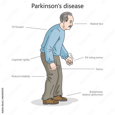 Man Patient With Parkinson Disease Diagram Hand Drawn Schematic Raster