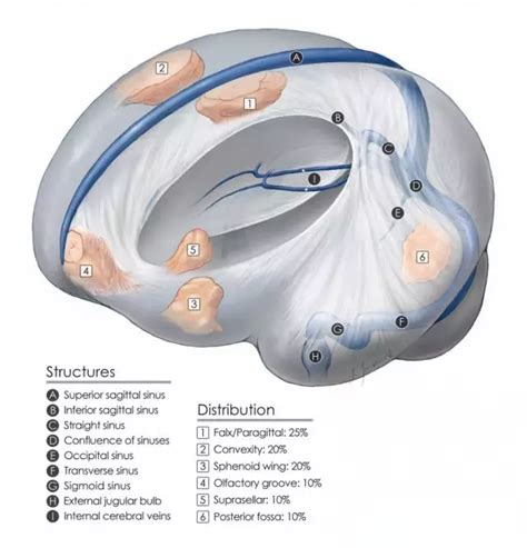 凸面脑膜瘤手术策略与技巧 The Neurosurgical Atlas全文翻译 脑医汇 神外资讯 神介资讯