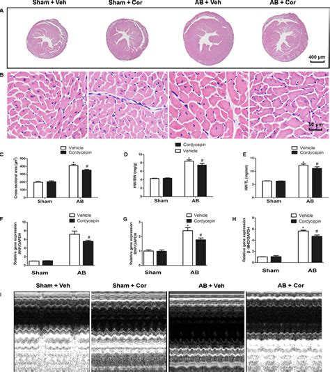 Cordycepin Attenuated Cardiac Hypertrophy Induced By Pressureoverload