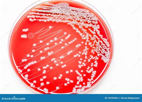 Bacterial Culture Growth On Blood Agar Media Staphylococcus Aureus