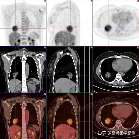 Pet Ct Malt