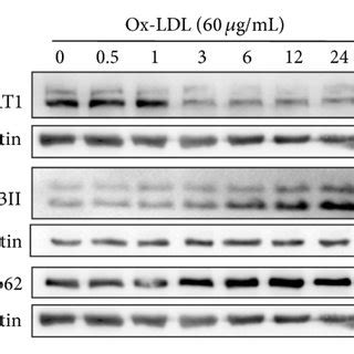 Resveratrol Increased The Expression Of SIRT1 And Enhanced Autophagic