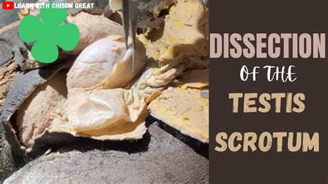 Dissection Of The Testis Scrotum Youtube