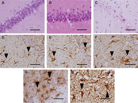 Hematoxylin and eosin staining and GFAP staining in the rat ... 