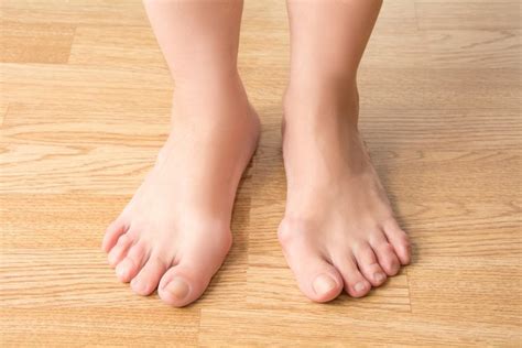 7 Tips For Preparing Your Home For Your Bunion Surgery Arizona Foot