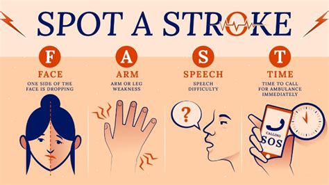 Fast Face Arms Speech Time Assessment At Poorni Health Care