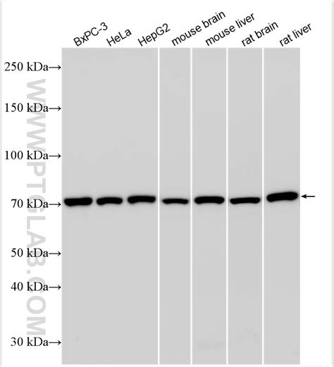 GRP78 BIP antibody 11587 1 AP Proteintech 武汉三鹰生物技术有限公司