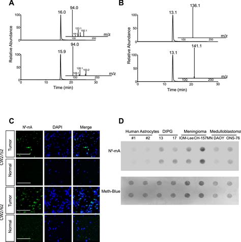 N6 Methyladenine Dna Modification In Glioblastoma Cell