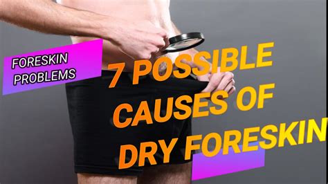 7 Possible Causes Of A Dry Foreskin Youtube