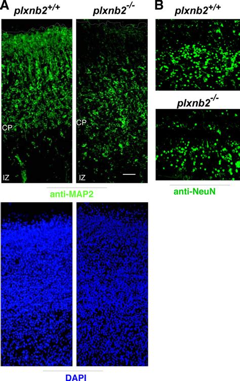 Mice Lacking Plexin B Show Reduced Numbers Of Mature Neurons In The