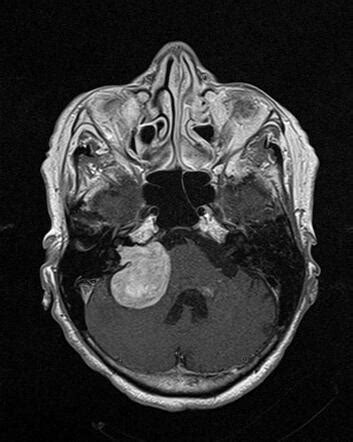 Image Radiopaedia Org