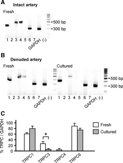 Detection Of TRPC MRNA In Native Rat Cerebral Arteries A And B