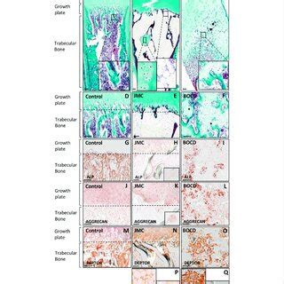 Jmc And Bocd Patients Show Aberrant Differentiation Of Skeletal