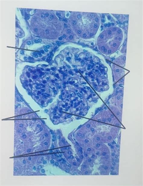 Solved Diagram 9: Glomerulus Histology urinary system | Chegg.com