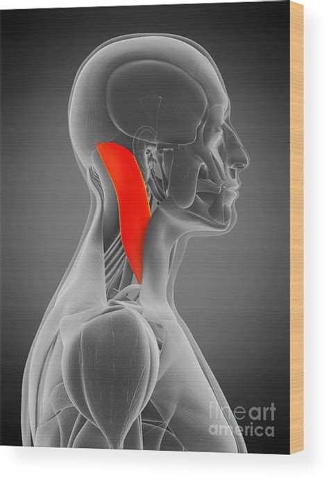 Sternocleidomastoid