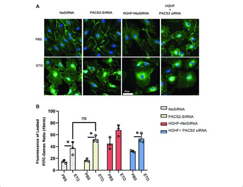 Inhibition of fatty acid β oxidation disturbs the barrier function of