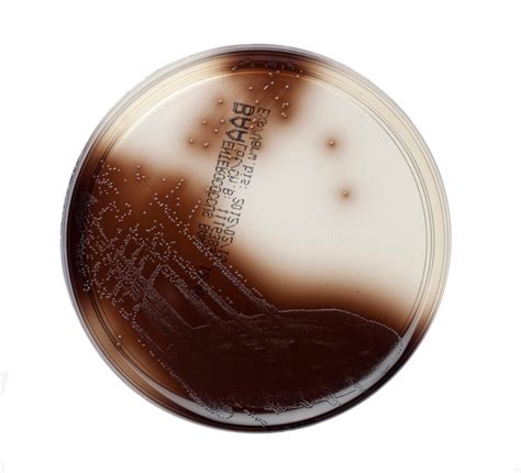 Thermo Scientific Bile Esculin Agar:Microbiological Media and Media ...