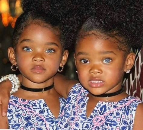 Twin Sisters Who Amazed The World With Their Extraordinary Beauty