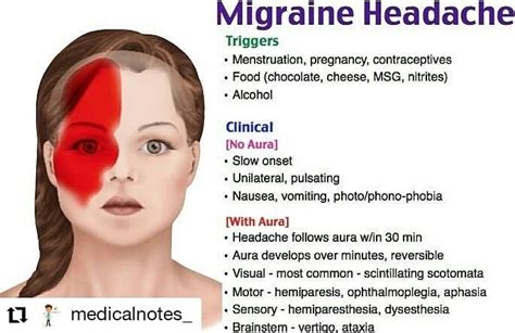 Read More And Download Book Immediately Repost Medicalnotes Migraine Headache Follow