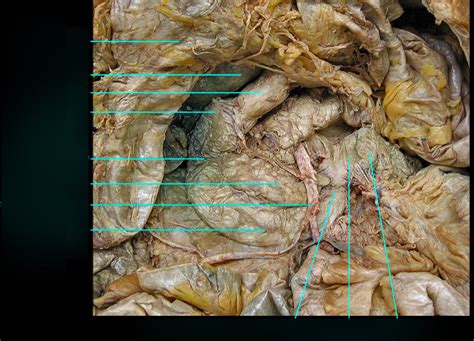 Duodenum And Pancreas Diagram Quizlet