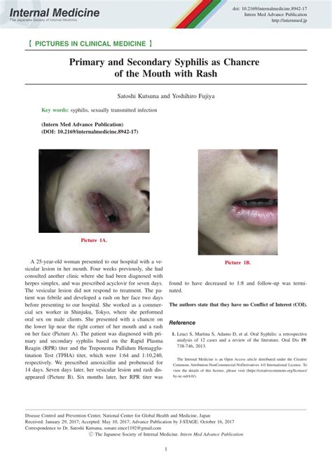 Syphilis Rash Lips | Lipstutorial.org