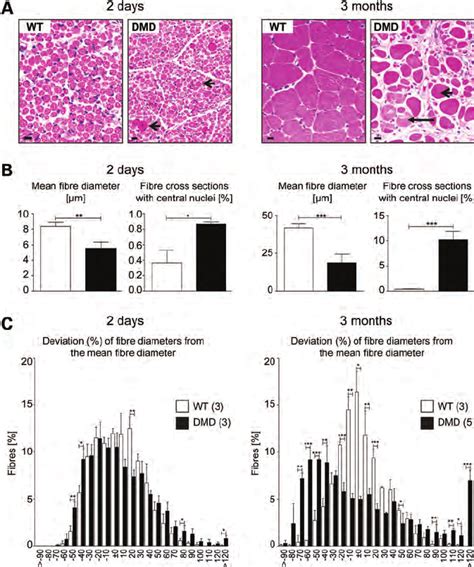 Quantification Of Structural Alterations Of Skeletal Muscle In Dmd