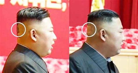 Kim Jong Un Fait Une Apparition Publique Avec Une Trange Tache Verte