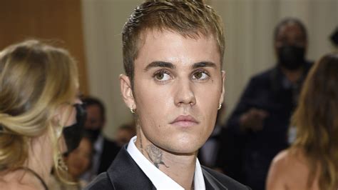 Justin Bieber Reaparece Para Explicar Cómo Se Encuentra Tras Sufrir