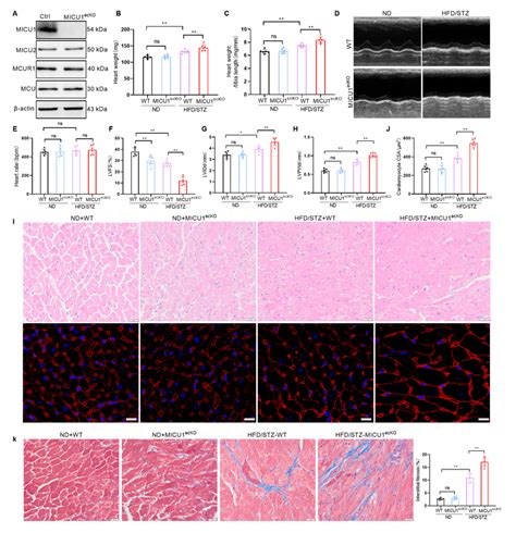 Endothelial Specific Knockout Of MICU1 Aggravates Diabetes Induced