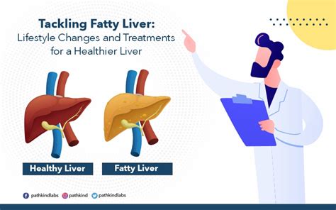 Jaundice Causes Symptoms And Diagnostic Tests For Liver Function