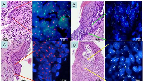 Dual Color Fluorescence In Situ Hybridization Of Tp Gene Q Green