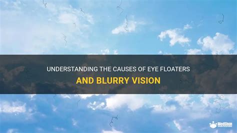 Understanding The Causes Of Eye Floaters And Blurry Vision | MedShun