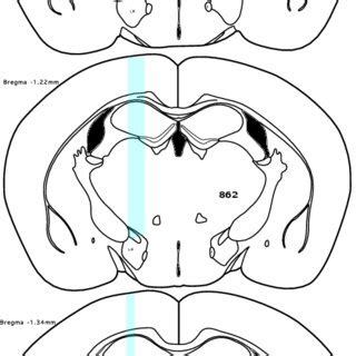 Figure Supplement 7 The Cannulae Placement In Mice Prepared Using The