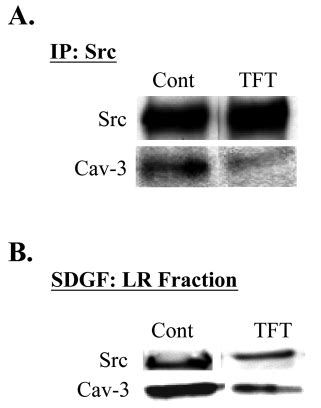 Effects Of The Tft Caveolin Mutation On Caveolin Binding To Src And