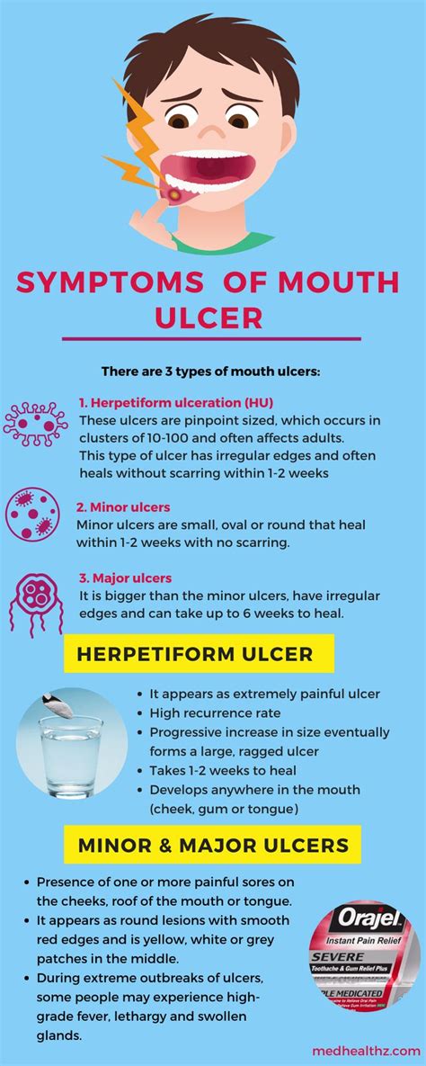 SYMPTOMS OF MOUTH ULCER | Mouth ulcers, Ulcers, Oral health care