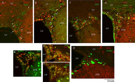 Shh Signaling Pathway Genes Are Expressed In Svz Nscs Abc Shh Smo