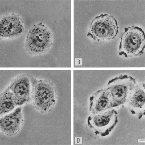 Formation Of Ruffling Membranes Of Single Isolated KB Cells A And E