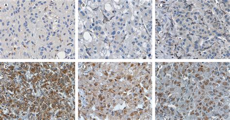 An Immunohistochemical Procedure To Detect Patients With Paraganglioma And Phaeochromocytoma