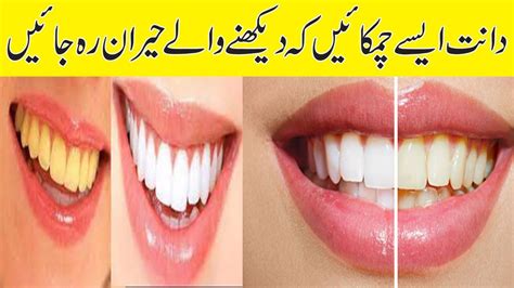 How To Whiten Teeth At Home Quickly Daanto Ki Peelahat Door Karne Ka