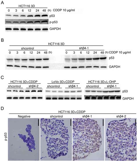 Integrin β4 reduces DNA damageinduced p53 activation in colorectal cancer