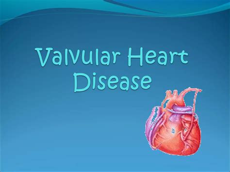 Valvular Heart Disease Ppt