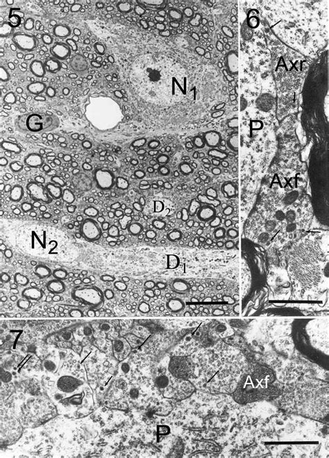 Low Power Electron Micrograph Showing Characteristic Elements In The