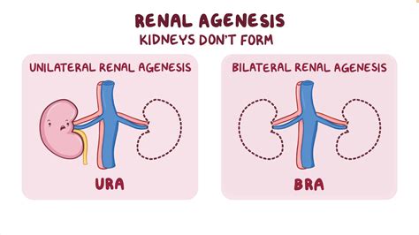 Renal Agenesis Video Anatomy Definition Function Osmosis