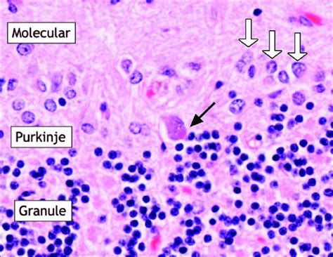 Purkinje Cells Cerebellum Histology