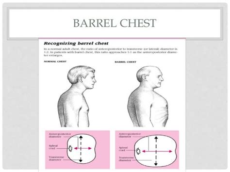 acute exacerbation  copd