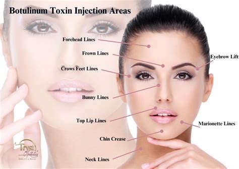 Anti Wrinkle Injections Tryst Aesthetics