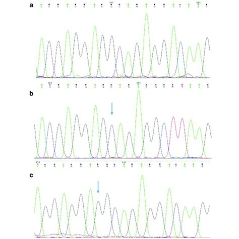 Mutations In Calr Exon 9 A Three Types Of Calr Exon 9 Frame Shifting Download Scientific