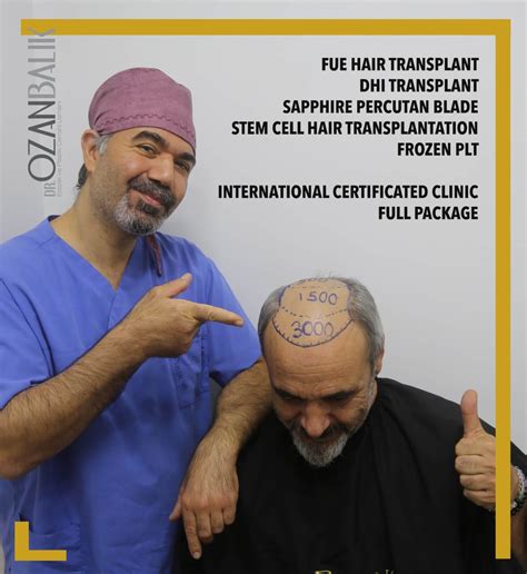 Jimmy Carr Hair Transplant Dr Ozan Bal K